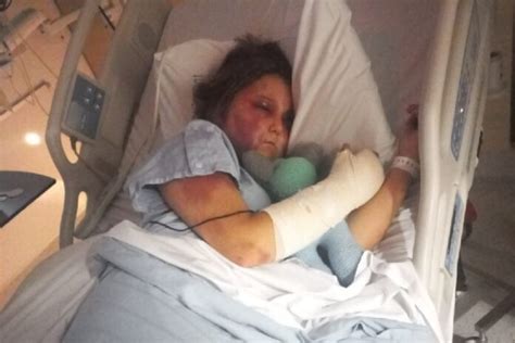 kiira hart|Kirra Hart’s story — Her brutal attack explained